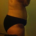 After- 3 days post