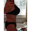 2 months side view still a little swollen