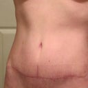 seven weeks PO - one more week before I can work my abs!