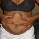 Before - front (the fat I had to hide all the time)