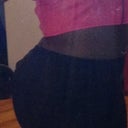 2 months post op