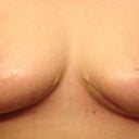 5 weeks!! Healing great!!!