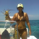 Before surgery: this summer, weight probably 145lbs