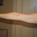 Before surgery