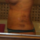 Day after...still puffy.
