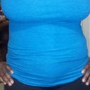 21 day post op