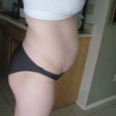 2 weeks preop
