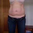 Pre-op muscles I want fixed