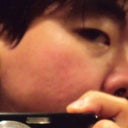 August 11, 2012 - Two weeks after second procedure

Left side of my face reflected in a mirror
