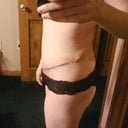 Left hip week 2
