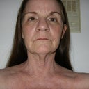 Night before surgery Oct 26,2010