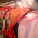 bruising on my leg, makes it pretty hard to get up and down.