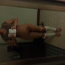 2 days post op