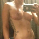 3 weeks post op