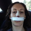 In the car after my surgery.