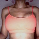 This is 11 days post op in a sports bra