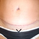 almost 8 weeks