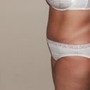 47 Days Post Op (almost 7 weeks)