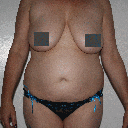 Pre-op front