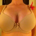 :) 8+ weeks post op 32DD VS measurements