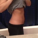 Post op 3 weeks