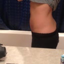 Post op 3 weeks