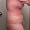 Day 16-still hunched slight curve to back need to get better compression to lower belly