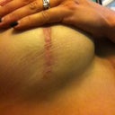otherside underneath at 8 months