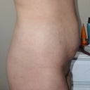 4 Weeks Right Side