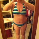 2 Days Pre-Op, Front with Apron Hiding!