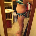2 Days Pre-Op, Side View