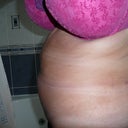 Standing.......on this one you can see how much skin and fat is on my back.  I enquired about having lipo on my "back boobs" done at the same time but because I'd be lay on my back for 3 hours whilst having my upper abs lipo and tt done, the doctor said I couldn't.  Gutted about it but understand.....so it goes on the "list"