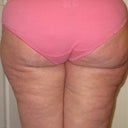 Before, Banana Roll, Inner and Outer thigh 12/12
