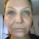 Day 7 1/2 ID mineral cover up to right side of face.  Will practice some blending with bronzer and blush to mask demarcation between face/neck.