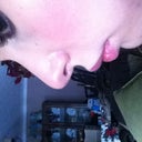 profile 19 days post op