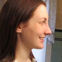 One Month post op. Smile, tip doesn't droop. Tip looks a little overprojected.