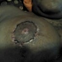 NIPPLE