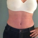8 weeks post op
