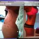 pre-surgery and 9 mons post op of first surgery! sorry about the picture of a picture!
