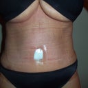 Took more pics tonite, these are more like how I see myself than the others, my daughter took the first ones and she was looking down at me (I am so short!).  I took this one and it is at eye level ha!  All is good, even with swelling! Day 5 post op!  I have always had small hips and big boobs and now I have a flat tummy again!