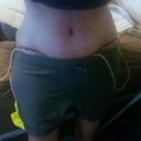 Post Op Day 5..same position but you can see the swollen tummy area