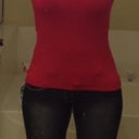 3.5 months post op