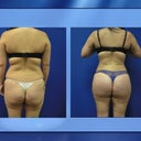 side by side view