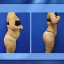 side by side view