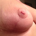 The scars are fading already on righty.