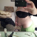 Less than one month pre-op 150lbs, you can really see my true shape shining through when I pull my skin away.