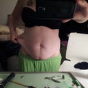 Less than one month pre-op 150lbs, INSANE!