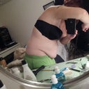Less than one month pre-op 150lbs, nobody's skin should hang to their crotch when they bend over.