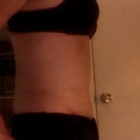 Side view at 6 weeks.  The swelling has gone down over the pubis area and my stomach is much flatter than it was 2.5 weeks ago!