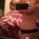 7 weeks post op side view
